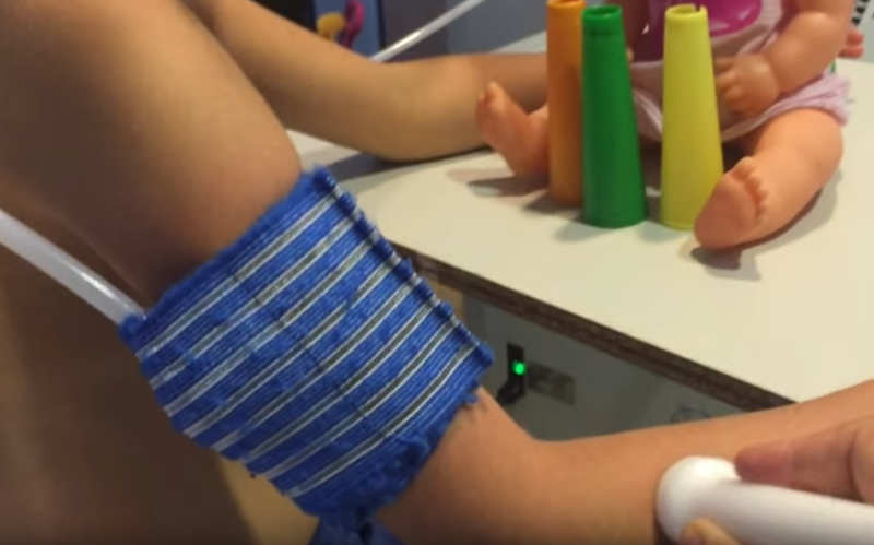 Terapia VIBRA en una niña con Hemiparesia infantil